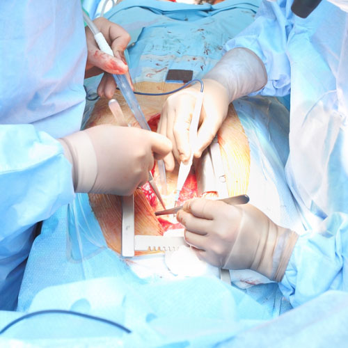 Cardiothoracic Surgery in Vijayawada
